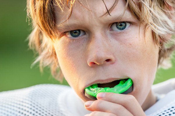 mouth guard chicago